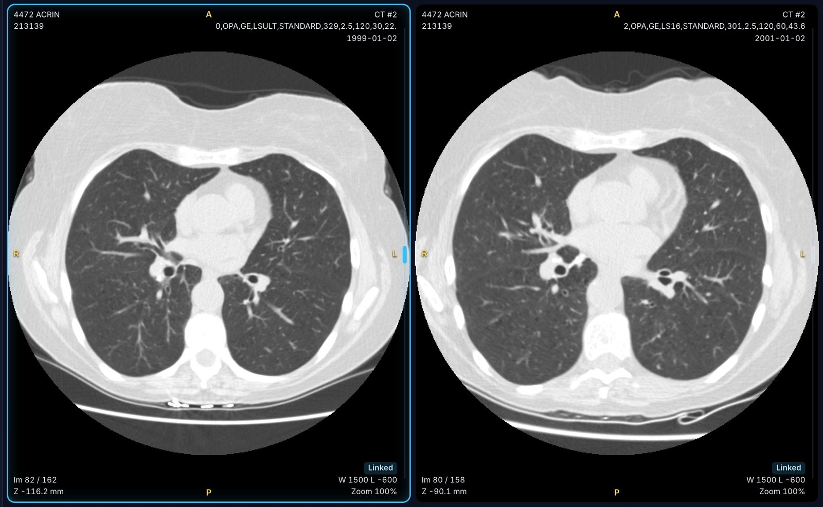 Comparing a CT with one from two years earlier